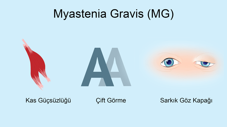Myastenia Gravis Nedir?