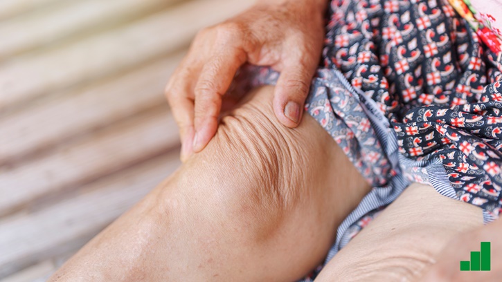 Osteoartrit Nedir? Fizik Tedavi ve Rehabilitasyon Süreci